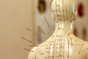 L’acupuncture au secours de la dépression